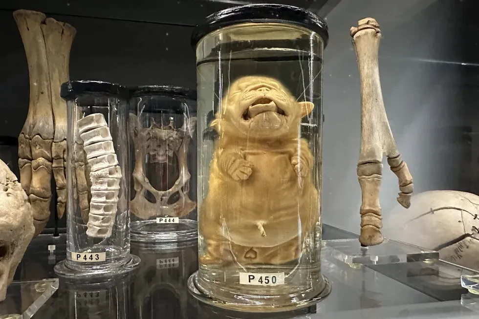 Parts of different creatures preserved in liquid and placed in glass display cases.